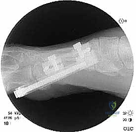 تقييم جراحي متقدم في عيادة الدكتور محمد هطيف بصنعاء