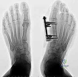 Clinical Image