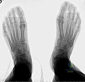 Clinical Image
