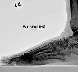 Clinical Image