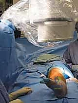 تشخيص كسور الساق بالأشعة