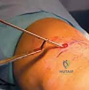 الأستاذ الدكتور محمد هطيف أثناء تقييم حالة أحد الأطفال