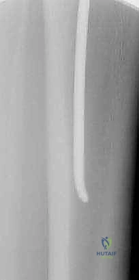 صورة توضيحية للتشخيص الدقيق لكسور قصبة الساق