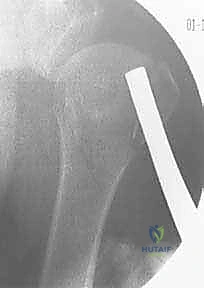 Clinical Image