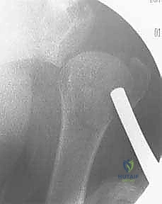 Clinical Image