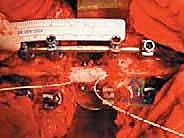 Clinical Image