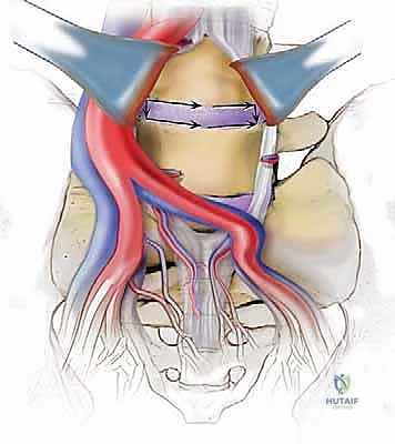 استخدام الرنين المغناطيسي في التشخيص