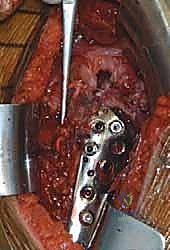Clinical Image
