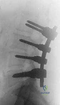 Clinical Image