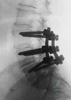 Clinical Image