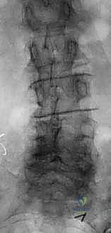 Clinical Image