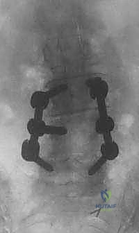 Clinical Image