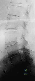 Clinical Image