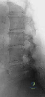 Clinical Image