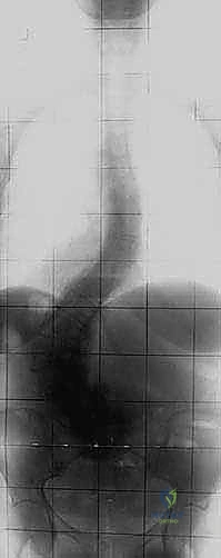 Clinical Image