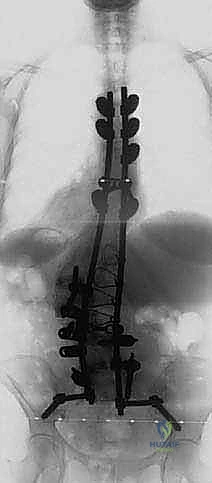 Clinical Image