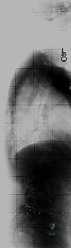 Clinical Image