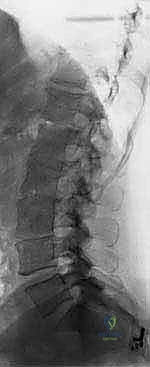 Clinical Image