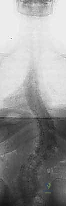Clinical Image