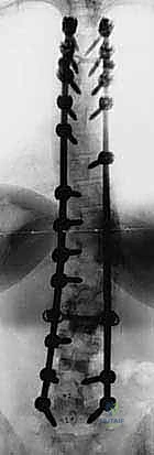 Clinical Image