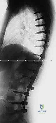 Clinical Image