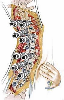 Clinical Image