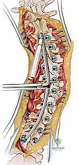 Clinical Image
