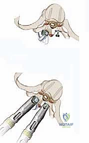 Clinical Image