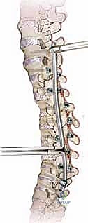 Clinical Image