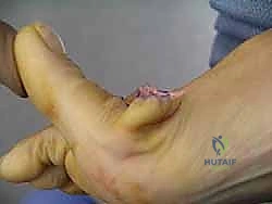 تقنيات الجراحة المتقدمة في عيادة الدكتور هطيف