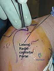 Clinical Image