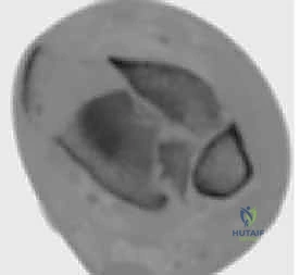 OITE & ABOS Orthopedic Board Prep: Knee & Shoulder MCQs | Part 54