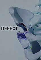 Masterclass: Extra-Articular Resection and Reconstruction of Supra-acetabular Metastatic Lesions