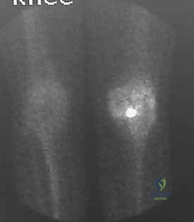 التخطيط الرقمي للعملية