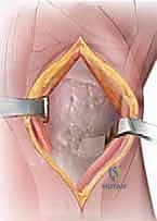 خطوات التخدير والتعقيم