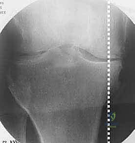 أهمية الحفاظ على النشاط البدني