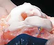 Clinical Image