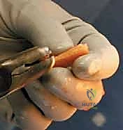 Clinical Image