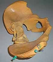 الأستاذ الدكتور محمد هطيف أثناء إجراء جراحة دقيقة