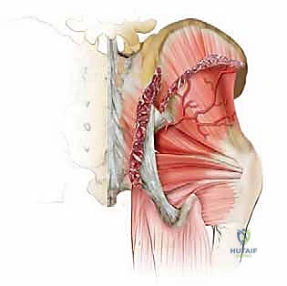 الخلايا العظمية وعملية تكوين العظم الجديد