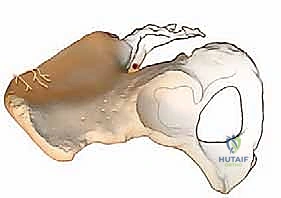 دواعي زراعة العظم في العمود الفقري