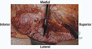 التحضير للعملية الجراحية والفحوصات الطبية