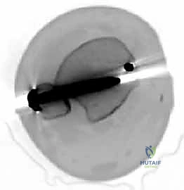 Clinical Image