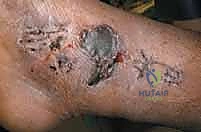 Clinical Image