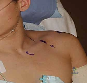 غرفة العمليات وتجهيزات التخدير الحديثة