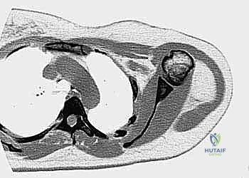 توجيه الإبرة باستخدام جهاز C-arm