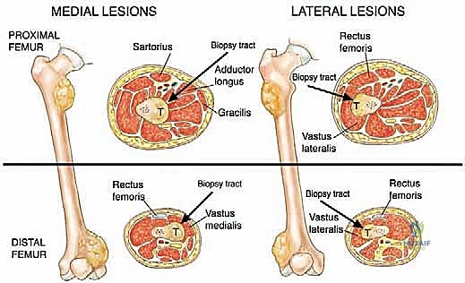 استشارة طبية مع الدكتور محمد هطيف في صنعاء
