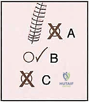 الراحة بعد إجراء الخزعة