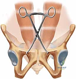 تشريح الحوض والمفصل العاني