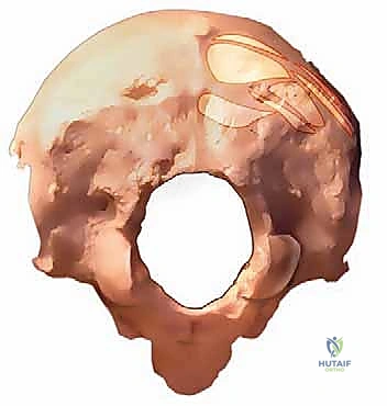 توضيح المعالم العظمية لعظم القذالي والفقرات العنقية العلوية